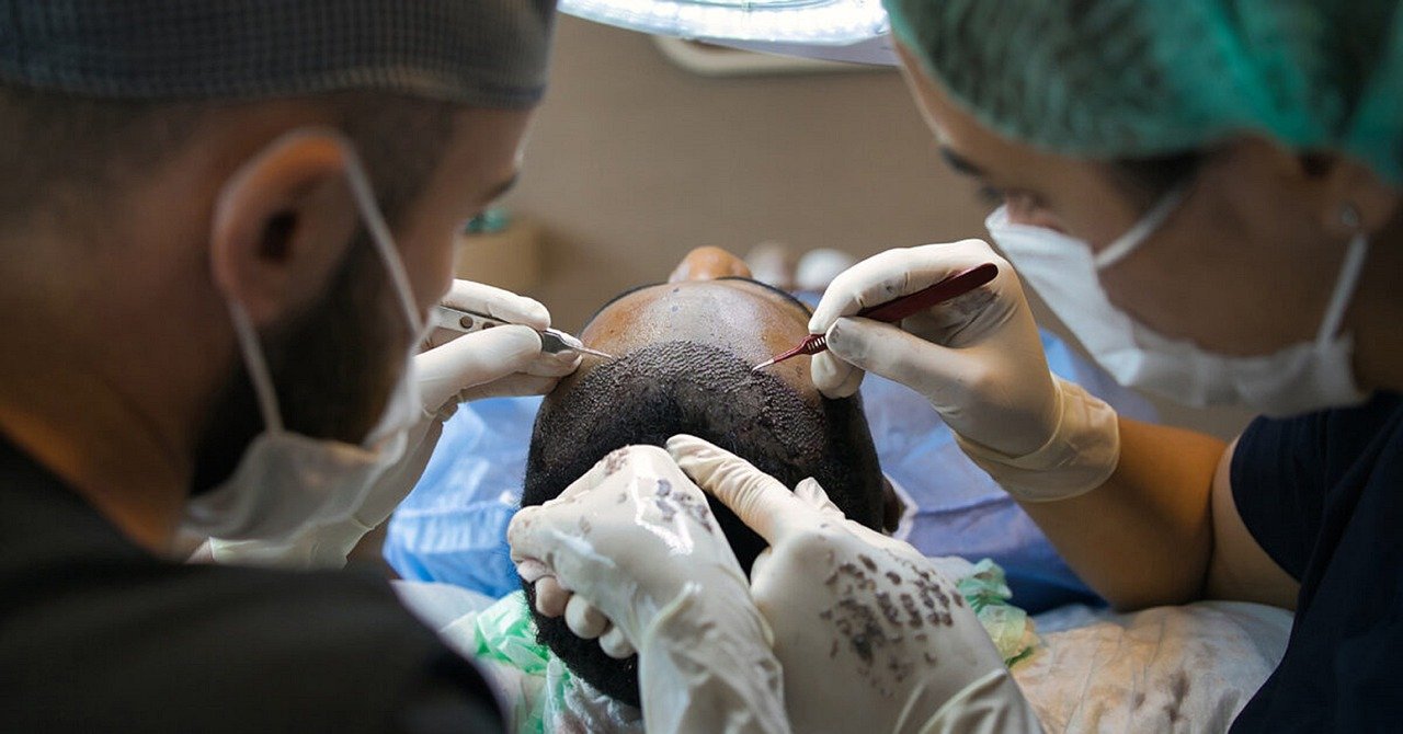 hair transplant, treatment, surgery