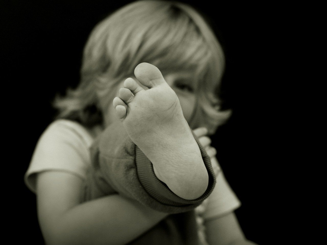 Flat Foot in Children and Its Treatment