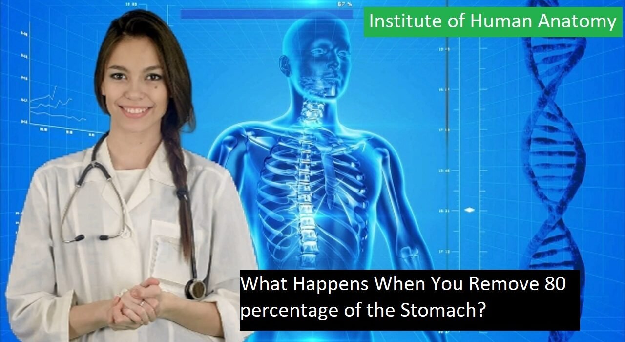 What Happens When You Remove 80 percentage of the Stomach