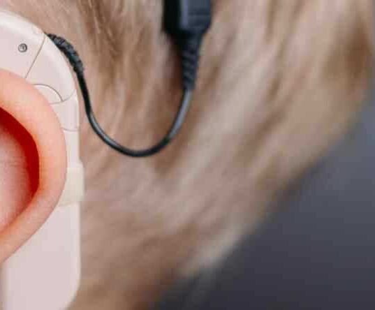 Cochlear Implant