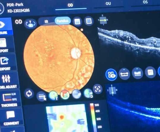 Digital Subtraction Angiography (DSA)